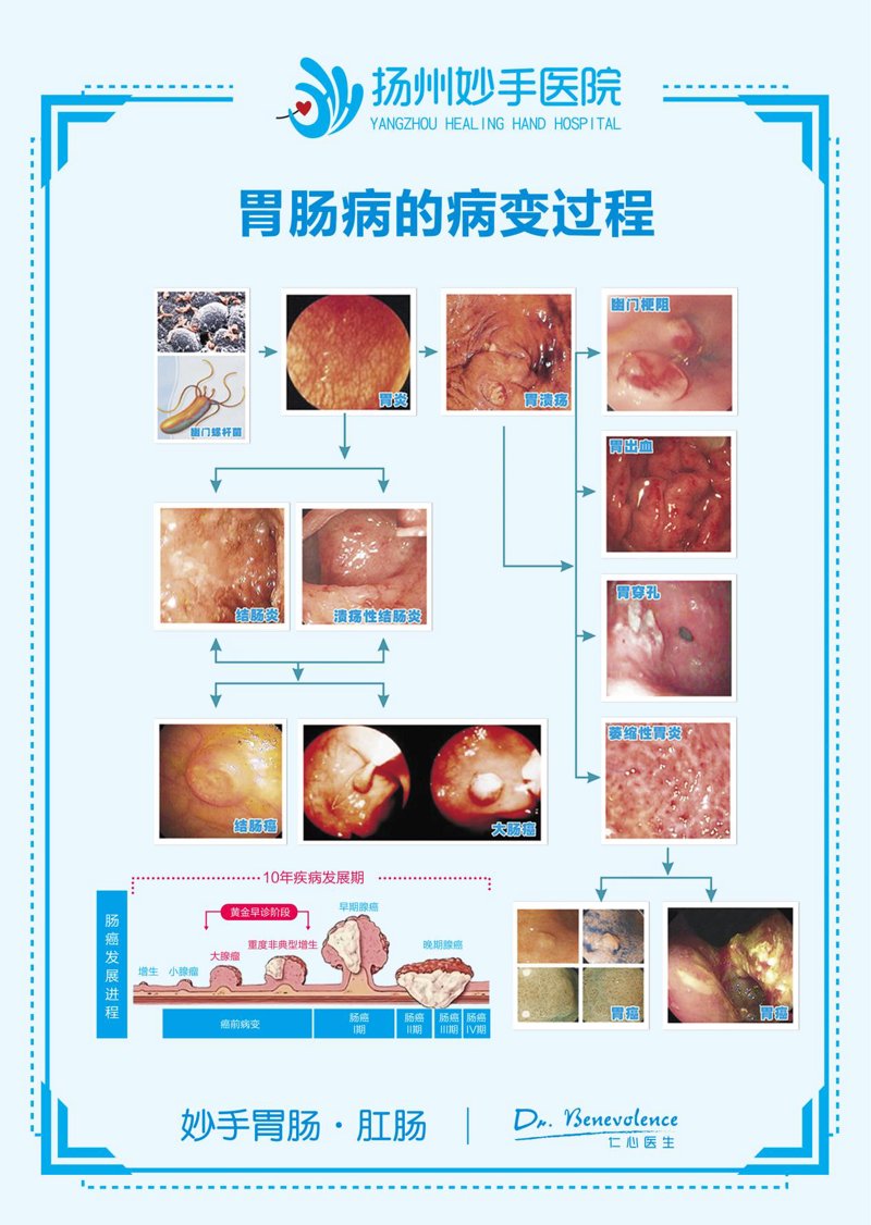 胃肠病专科
