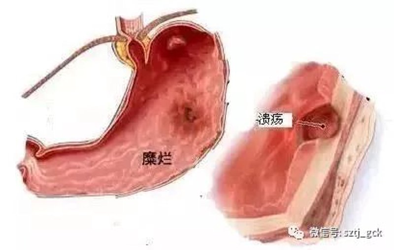 吉林胃肠病医院的诊疗动态：肠道健康不容忽视