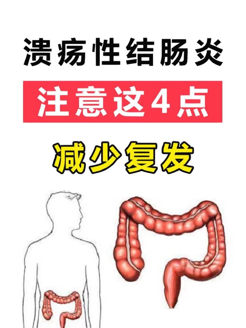 吉林胃肠病医院如何选择？一份实用的选购指南