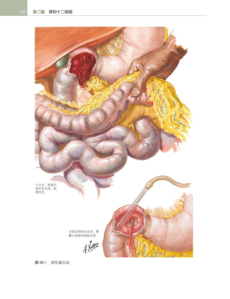 聚焦胃肠健康:北医胃肠病医院的最新发展