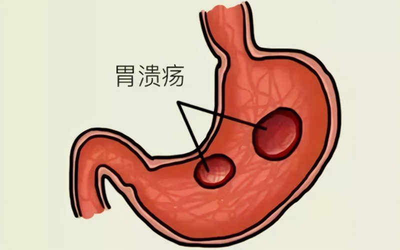胃病医院:寻找心中的守护者